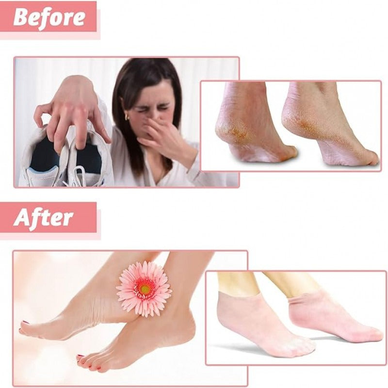Silicon Moisturizing Gel Heel Socks Exfoliating And Preventing Dryness Foot Skin Rejuvenation